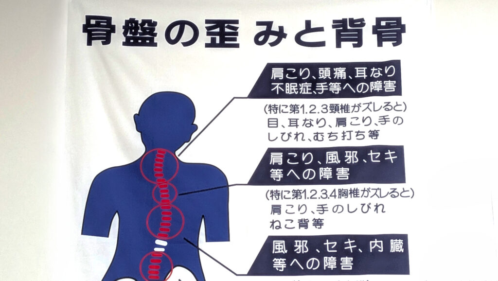 カイロプラクティック
